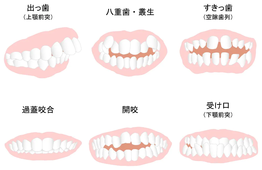 治療範囲が広い